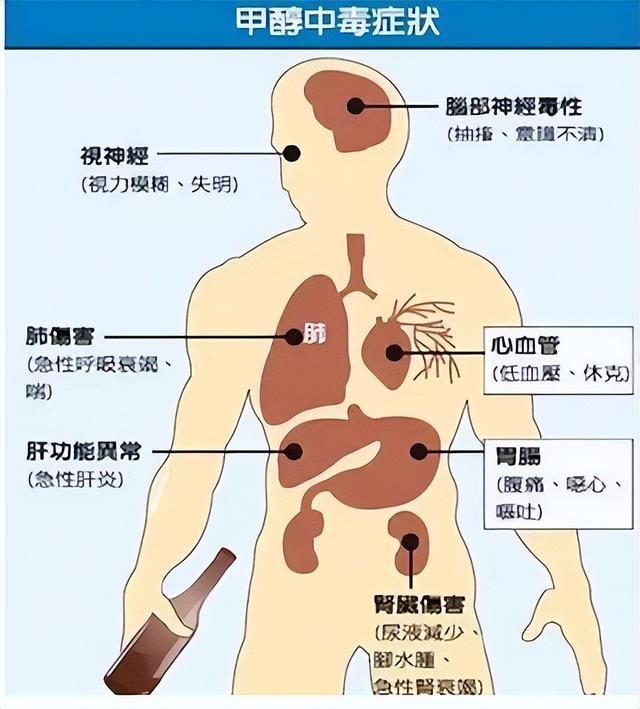 甲醛的中毒癥狀很多.jpeg